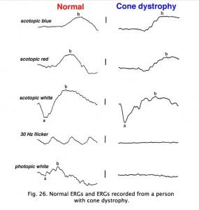 Cone26