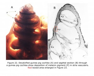 22Cochlea
