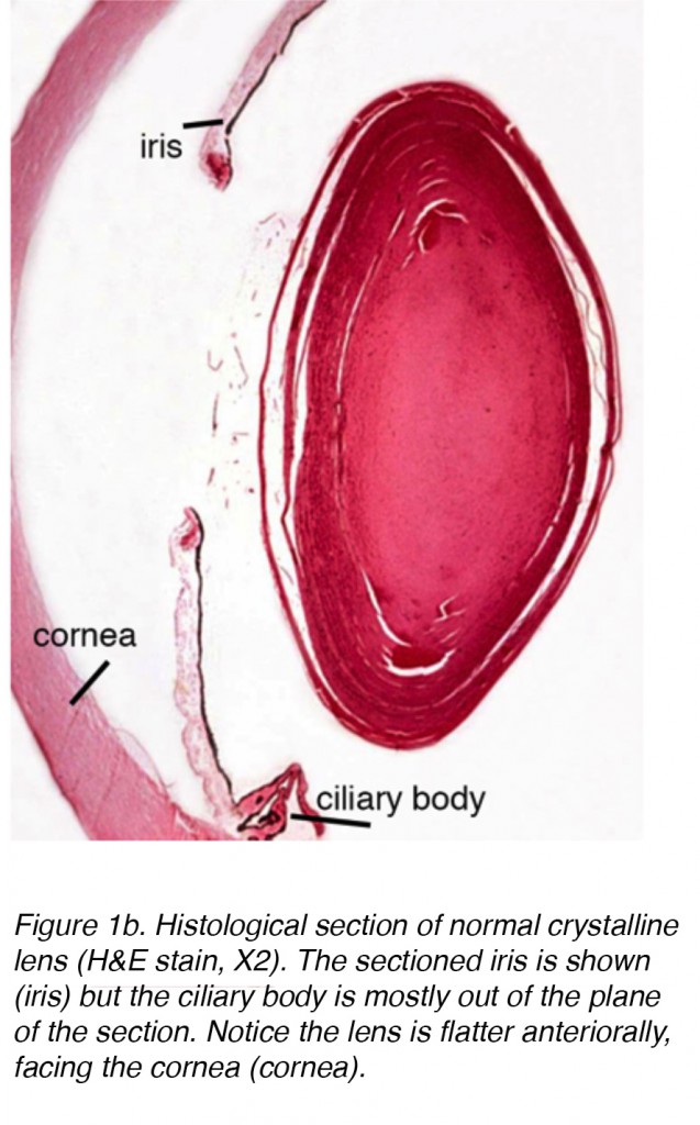 Fig 1b